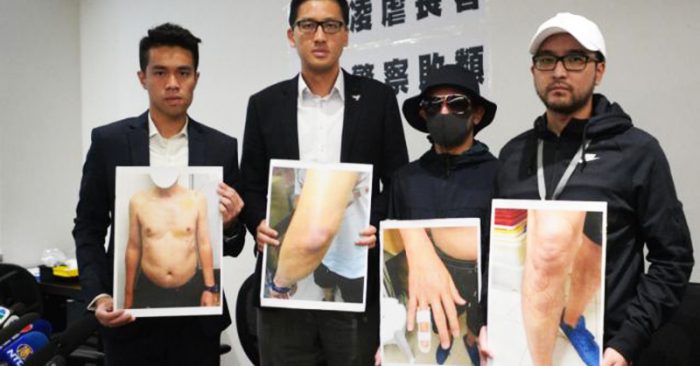 Các nghị viên phái dân chủ đưa những tấm hình bị thương của người bị hại ra trước công chúng trong một cuộc họp ngày 20/8.